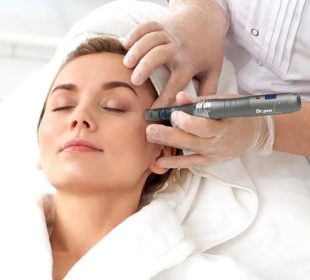 What Is Microneedling? Benefits, Process, Results & Aftercare Explained