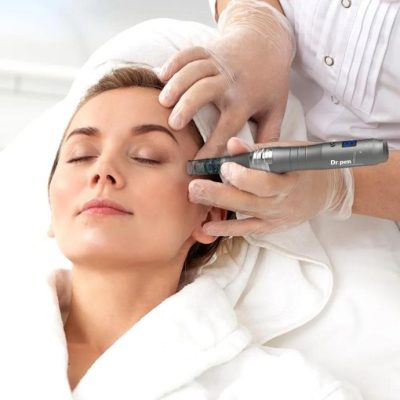 What Is Microneedling? Benefits, Process, Results & Aftercare Explained