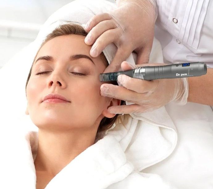 What Is Microneedling? Benefits, Process, Results & Aftercare Explained